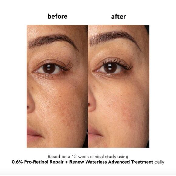 NEW Boscia 0.6% Pro-Retinol Repair + Renew Waterless Advanced Treatment - Picture 2 of 7